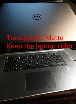 Laptop ugljičnih vlakana, Vinil koža naljepnica Poklopac za MSI GS75 17.3